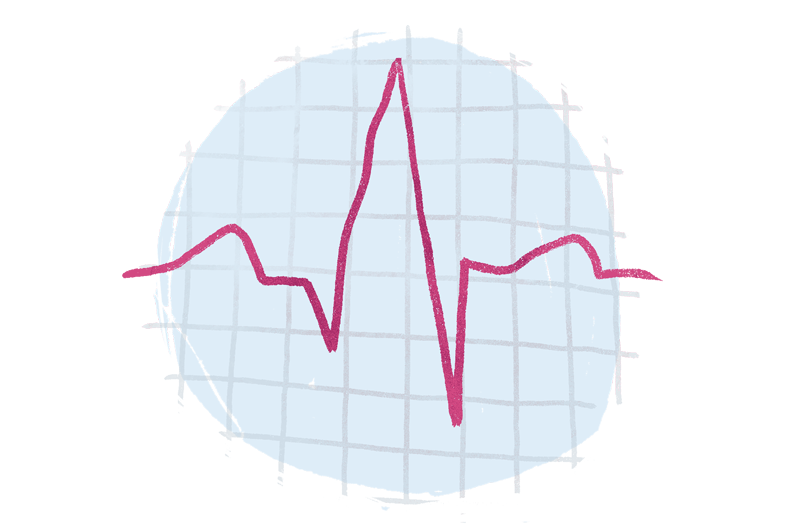 ECG, TMT